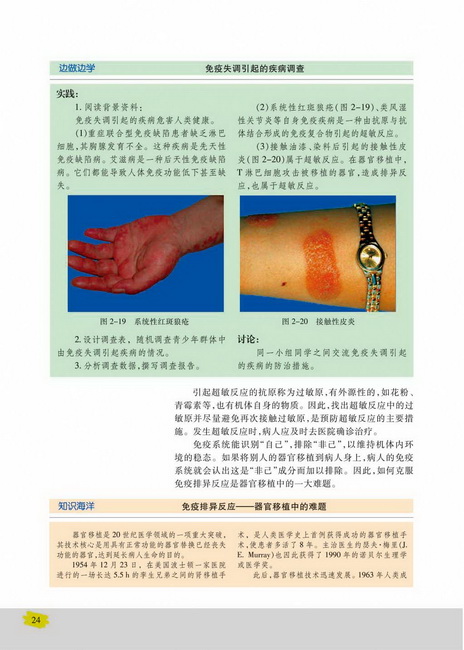 免疫失调引起的疾病(第24页)