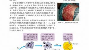苏教版高一生物必修1（分子与细胞）电子课本细胞衰老和凋亡(第91页)