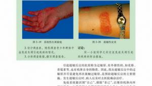 苏教版高二生物必修3（稳定与环境）电子课本免疫失调引起的疾病(第24页)